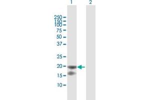 Western Blotting (WB) image for anti-Interleukin 1 Receptor Antagonist (IL1RN) (AA 1-177) antibody (ABIN517004)