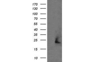 Image no. 1 for anti-Amyloid P Component, Serum (APCS) antibody (ABIN1500900) (APCS 抗体)