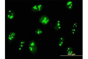 Immunofluorescence of purified MaxPab antibody to C14orf169 on HeLa cell. (C14orf169 + NO66 抗体  (AA 1-641))