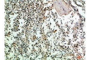 Immunohistochemical analysis of paraffin-embedded Human-spleen, antibody was diluted at 1:100
