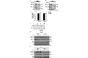 Western Blotting (WB) image for anti-Collagen, Type I (COL1) antibody (ABIN5596819)