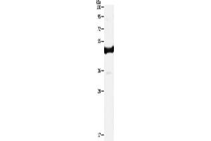 Western Blotting (WB) image for anti-Interleukin 11 Receptor, alpha (IL11RA) antibody (ABIN2421099) (IL11RA 抗体)