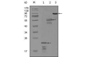Western blot analysis using ERBB3 mouse mAb against truncated Trx-ERBB3 recombinant protein (1), MBP-ERBB3 (aa1175-1275) recombinant protein (2) and truncated ERBB3(aa665-1342)-hIgGFc transfected CH0-K1 cell lysate (3). (ERBB3 抗体)