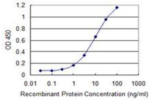 Detection limit for recombinant GST tagged UGT1A6 is 0. (UGT1A6 抗体  (AA 44-143))