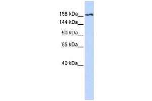 Western Blot showing KDR antibody used at a concentration of 1-2 ug/ml to detect its target protein. (VEGFR2/CD309 抗体  (N-Term))