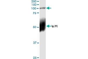 Immunoprecipitation of PLOD2 transfected lysate using anti-PLOD2 MaxPab rabbit polyclonal antibody and Protein A Magnetic Bead , and immunoblotted with PLOD2 MaxPab rabbit polyclonal antibody (D01) . (PLOD2 抗体  (AA 1-758))
