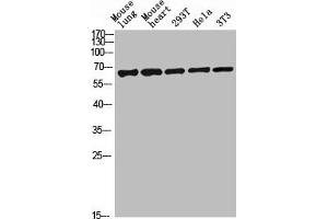 Western blot analysis of mouse-lung mouse-lung lysate, antibody was diluted at 2000. (C-Type Lectin Domain Family 4, Member M (CLEC4M) (AA 271-320) 抗体)