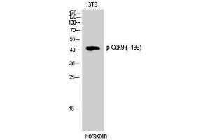 Western Blotting (WB) image for anti-Cyclin-Dependent Kinase 9 (CDK9) (pThr186) antibody (ABIN3179547) (CDK9 抗体  (pThr186))