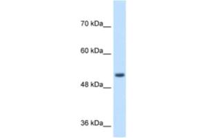 Western Blotting (WB) image for anti-Signal Peptide Peptidase-Like 2B (SPPL2B) antibody (ABIN2464000) (SPPL2B 抗体)