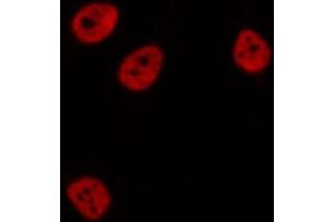 ABIN6276831 staining  Hela cells by IF/ICC. (CTBP1 抗体  (Internal Region))