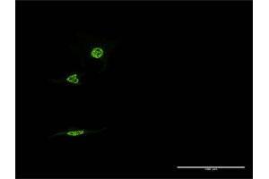 Immunofluorescence of monoclonal antibody to NR1D1 on HeLa cell. (NR1D1 抗体  (AA 233-322))
