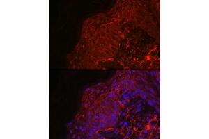 Immunofluorescence analysis of human skin using EGF Rabbit pAb (ABIN6133981, ABIN6139971, ABIN6139973 and ABIN6217680) at dilution of 1:100 (40x lens). (EGF 抗体  (AA 850-950))