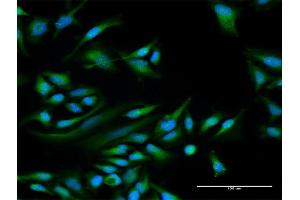 Immunofluorescence (IF) image for anti-Protein Phosphatase 1, Regulatory (Inhibitor) Subunit 1C (PPP1R1C) (AA 1-109) antibody (ABIN531021)