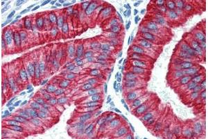 Uterus, Human: Formalin-Fixed, Paraffin-Embedded (FFPE) (Cytokeratin 19 抗体  (C-Term))