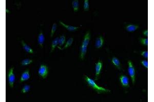 Immunofluorescent analysis of Hela cells using ABIN7151933 at dilution of 1:100 and Alexa Fluor 488-congugated AffiniPure Goat Anti-Rabbit IgG(H+L) (EMP3 抗体  (AA 25-65))
