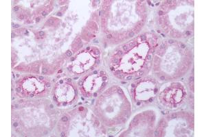 Human Kidney: Formalin-Fixed, Paraffin-Embedded (FFPE) (Serotonin Receptor 4 抗体  (Cytoplasmic Domain))
