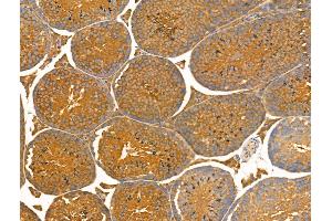 ABIN7093239 and ABIN7097252 at 1/100 staining Mouse testis tissue by IHC-P. (MLKL 抗体  (pSer360))