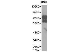 Western Blotting (WB) image for anti-Vitronectin (VTN) antibody (ABIN1875340) (Vitronectin 抗体)