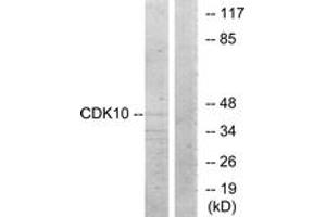 Western blot analysis of extracts from 293 cells, using CDK10 Antibody.