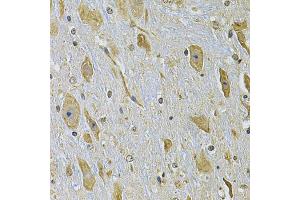 Immunohistochemistry of paraffin-embedded mouse brain using ITGA2 Antibody. (ITGA2 抗体)