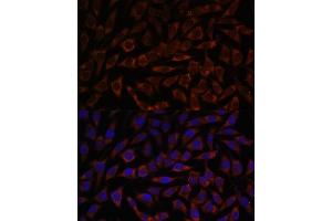 Immunofluorescence analysis of L929 cells using BZW2 antibody (ABIN7265831) at dilution of 1:100. (BZW2 抗体  (AA 190-300))