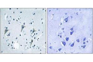 Immunohistochemistry analysis of paraffin-embedded human brain tissue, using GPR85 Antibody. (GPR85 抗体  (AA 181-230))