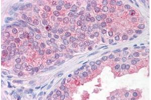 Anti-TM9SF1 antibody  ABIN1049413 IHC staining of human, prostate. (TM9SF1 抗体  (Internal Region))