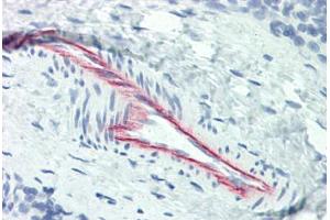 Human Thymus, Vessel (formalin-fixed, paraffin-embedded) stained with HSPG2 antibody ABIN337194 at 5 ug/ml followed by biotinylated anti-mouse IgG secondary antibody ABIN481714, alkaline phosphatase-streptavidin and chromogen. (HSPG2 抗体)