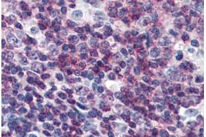 Human Tonsil (formalin-fixed, paraffin-embedded) stained with CEBPB antibody ABIN364320 at 10 ug/ml followed by biotinylated anti-mouse IgG secondary antibody ABIN481714, alkaline phosphatase-streptavidin and chromogen. (CEBPB 抗体)