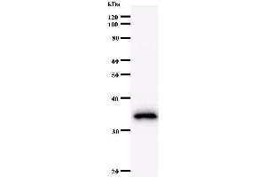 Western Blotting (WB) image for anti-MYC Associated Factor X (MAX) antibody (ABIN932461) (MAX 抗体)