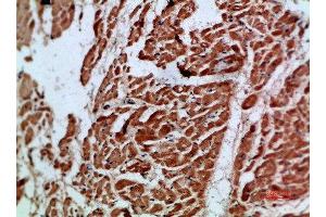 Immunohistochemical analysis of paraffin-embedded human-heart, antibody was diluted at 1:200 (ARTN 抗体  (AA 101-150))