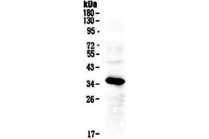 Western blot analysis of IGFBP2 using anti-IGFBP2 antibody . (IGFBP2 抗体  (AA 36-325))