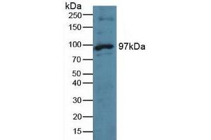 Detection of TTK in Human Hela Cells using Polyclonal Antibody to TTK Protein Kinase (TTK) (Mps1 抗体  (AA 532-786))