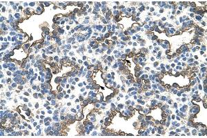 Human Lung (Podoplanin 抗体  (N-Term))