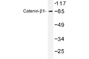 Image no. 1 for anti-Catenin (Cadherin-Associated Protein), beta 1, 88kDa (CTNNB1) antibody (ABIN272182) (CTNNB1 抗体)