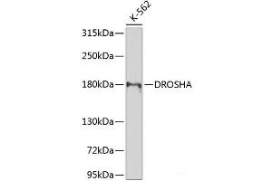 Western blot analysis of extracts of K-562 cells using DROSHA Polyclonal Antibody at dilution of 1:1000. (DROSHA 抗体)