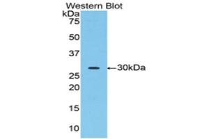 Western Blotting (WB) image for anti-Acrosin (ACR) (AA 43-291) antibody (ABIN1857876) (Acrosin 抗体  (AA 43-291))