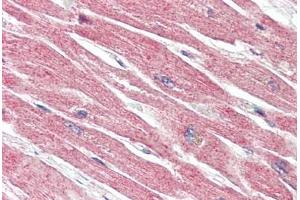 Human Heart (formalin-fixed, paraffin-embedded) stained with BECN1 antibody ABIN461895 at 5 ug/ml followed by biotinylated goat anti-rabbit IgG secondary antibody ABIN481713, alkaline phosphatase-streptavidin and chromogen. (Beclin 1 抗体  (N-Term))