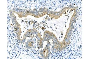 IHC analysis of Cytokeratin 8 using anti-Cytokeratin 8 antibody (ABIN6719478). (KRT8 抗体  (AA 107-325))