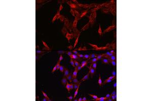 Immunofluorescence analysis of NIH/3T3 cells using ST Rabbit pAb (ABIN6128541, ABIN6148581, ABIN6148582 and ABIN6213980) at dilution of 1:200 (40x lens). (STAT6 抗体  (AA 1-180))