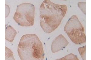 Immunohistochemistry (IHC) image for anti-Nitric Oxide Synthase 2, Inducible (NOS2) (AA 518-694) antibody (ABIN7432718)