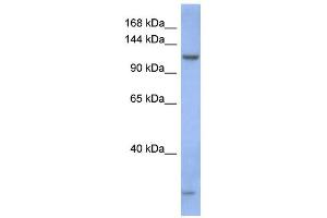 WB Suggested Anti-PIWIL1 Antibody Titration:  0. (PIWIL1 抗体  (N-Term))