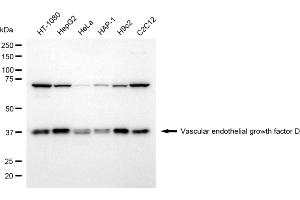 Western blotting analysis using Vascular endothelial growth factor D antibody (ABIN7797810).