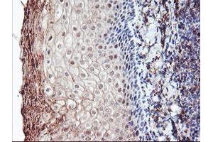 Image no. 5 for anti-Retinaldehyde Binding Protein 1 (RLBP1) antibody (ABIN1497622) (RLBP1 抗体)