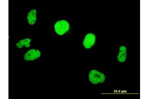 Immunofluorescence of purified MaxPab antibody to SMARCB1 on HeLa cell. (SMARCB1 抗体  (AA 1-385))