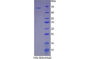 SDS-PAGE analysis of Human HSPD1 Protein. (HSPD1 蛋白)