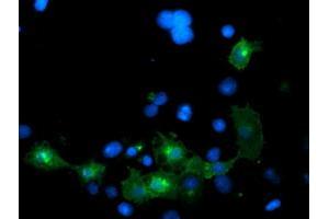 Anti-LRRC25 mouse monoclonal antibody (ABIN2455880) immunofluorescent staining of COS7 cells transiently transfected by pCMV6-ENTRY LRRC25 (RC209911). (LRRC25 抗体)