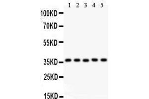 Anti- KLF6 antibody, Western blotting All lanes: Anti KLF6  at 0. (KLF6 抗体  (AA 38-205))