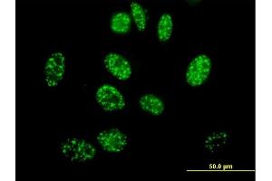 Immunofluorescence of purified MaxPab antibody to ELK4 on HeLa cell. (ELK4 抗体  (AA 1-405))