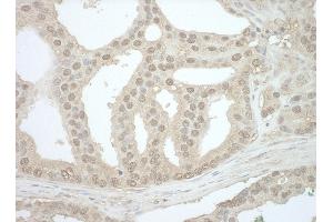 Immunohistochemistry (IHC) image for anti-Bridging Integrator 1 (BIN1) (AA 300-350) antibody (ABIN7454464)